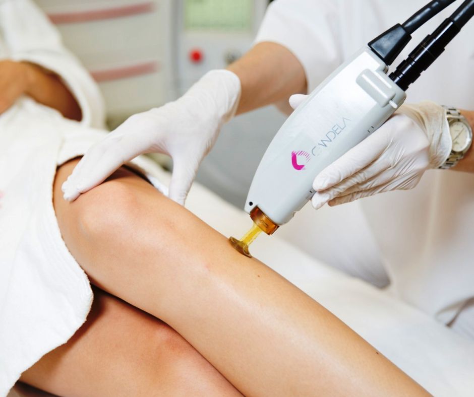 Candela GentleLase device